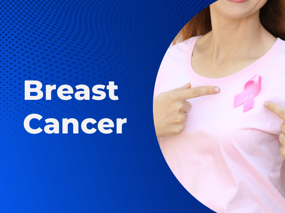 All You Need to Know About Breast Cancer