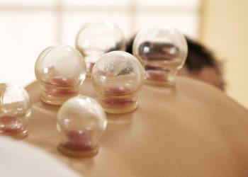 Cupping therapy – an ancient technique to improve blood flow